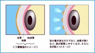 img-tp21-3.gif